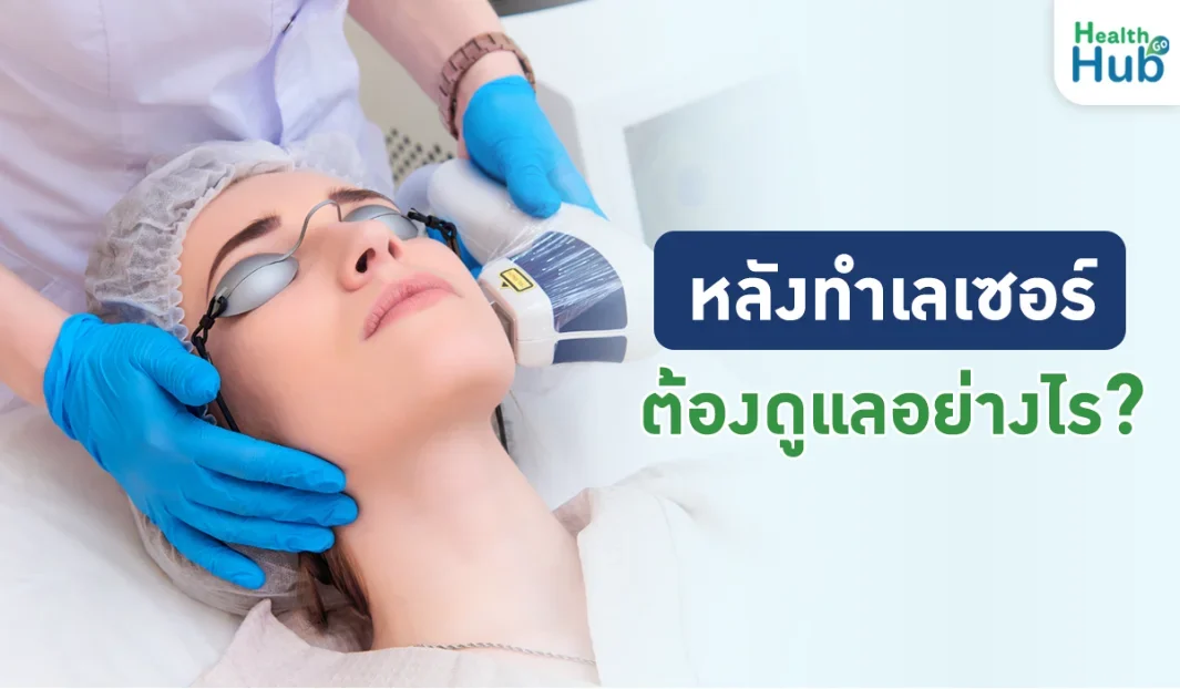 หลังทำเลเซอร์ต้องดูแลอย่างไร
