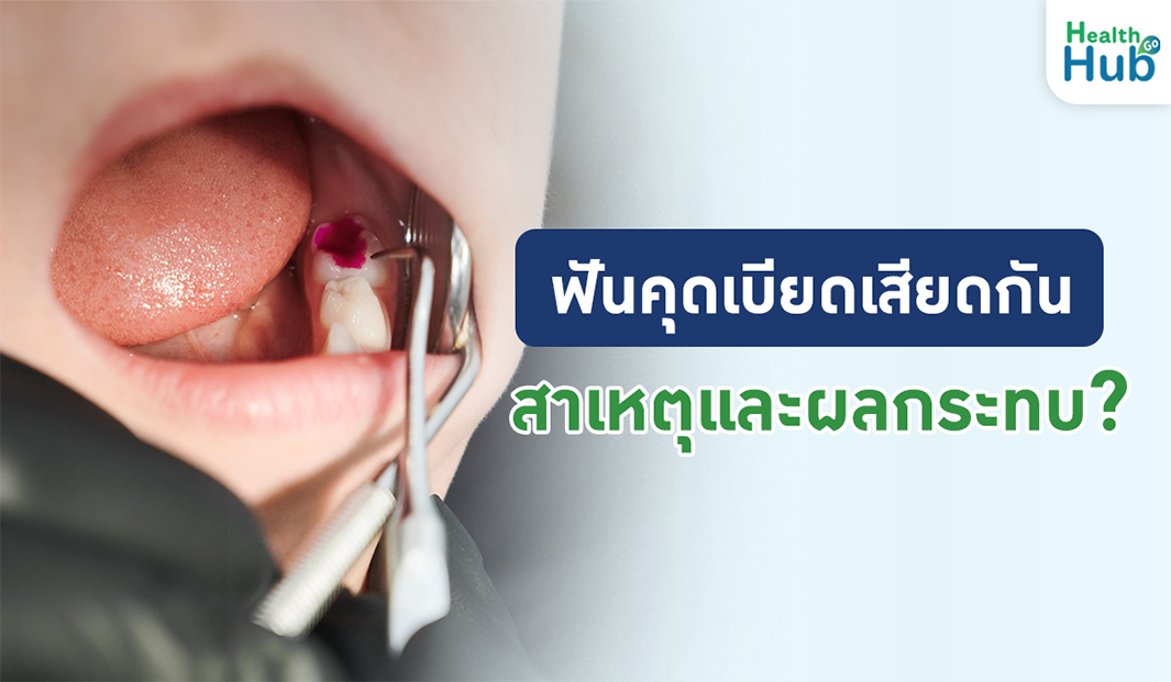 ฟันคุดเบียดเสียดกัน สาเหตุและผลกระทบ