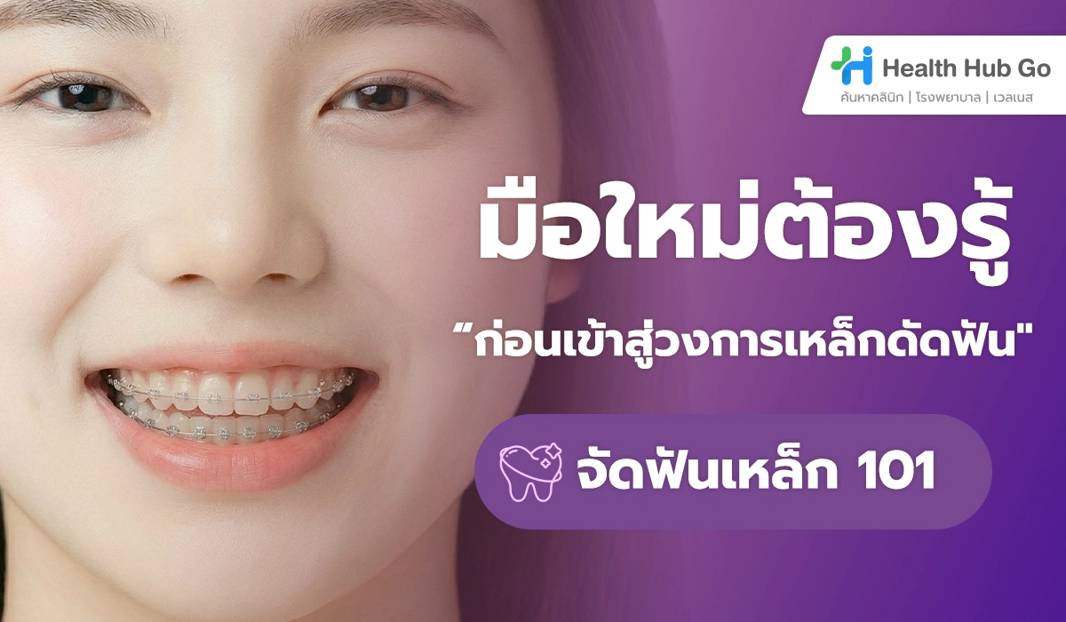 จัดฟันเหล็ก 101 : คู่มือฉบับเข้าใจจริง สำหรับคนที่กำลังตัดสินใจจัดฟัน