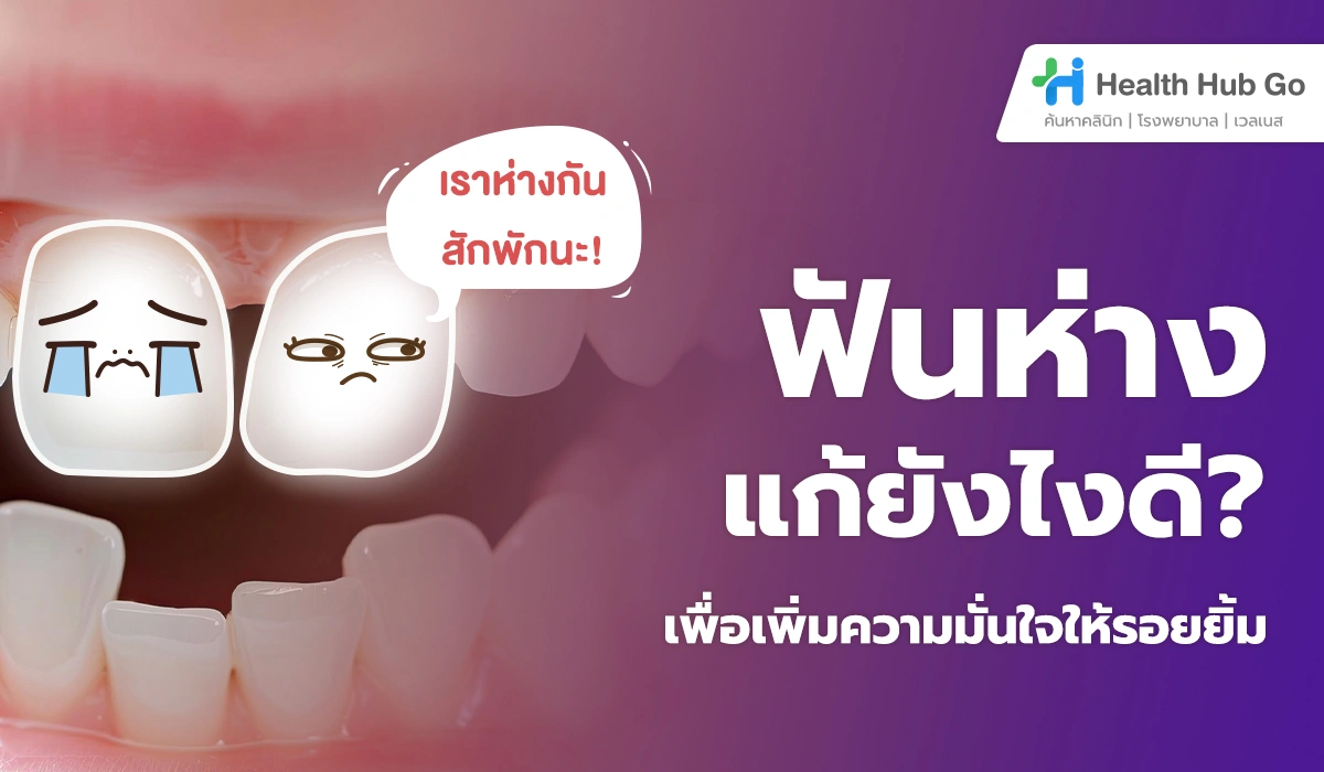ฟันห่าง แก้ยังไงดี? รวมวิธีปิดช่องว่างระหว่างฟัน เพิ่มความมั่นใจให้รอยยิ้ม