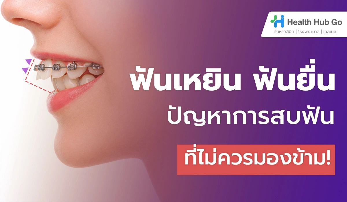 ฟันเหยิน ฟันยื่น ปัญหากวนใจที่แก้ได้มากกว่าแค่ความสวยงาม