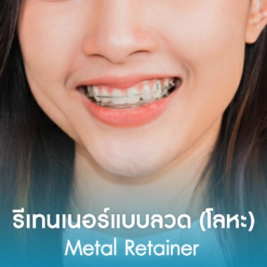 รีเทนเนอร์แบบลวด (โลหะ)