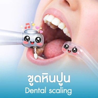 ขูดหินปูน